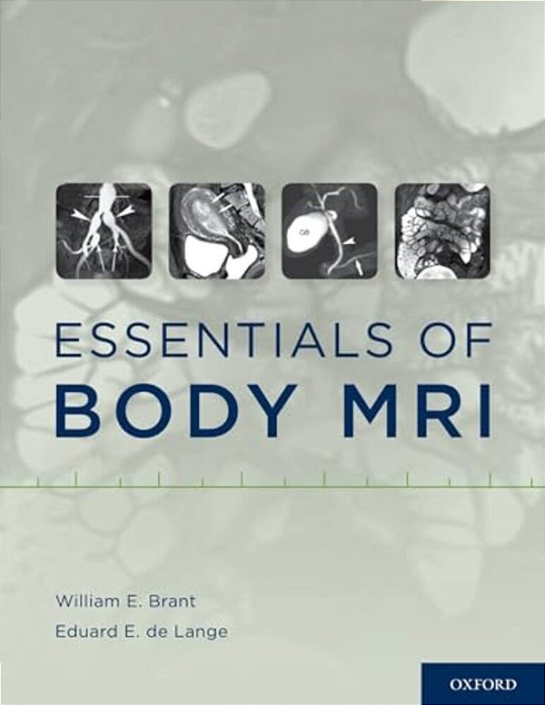Essentials Of Body Mri-..