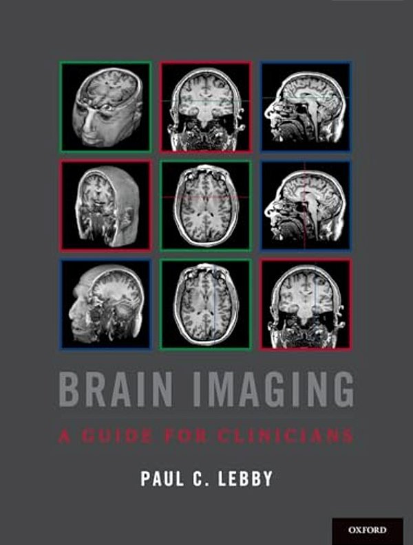 Brain Imaging: A Guide For Clinicians-..
