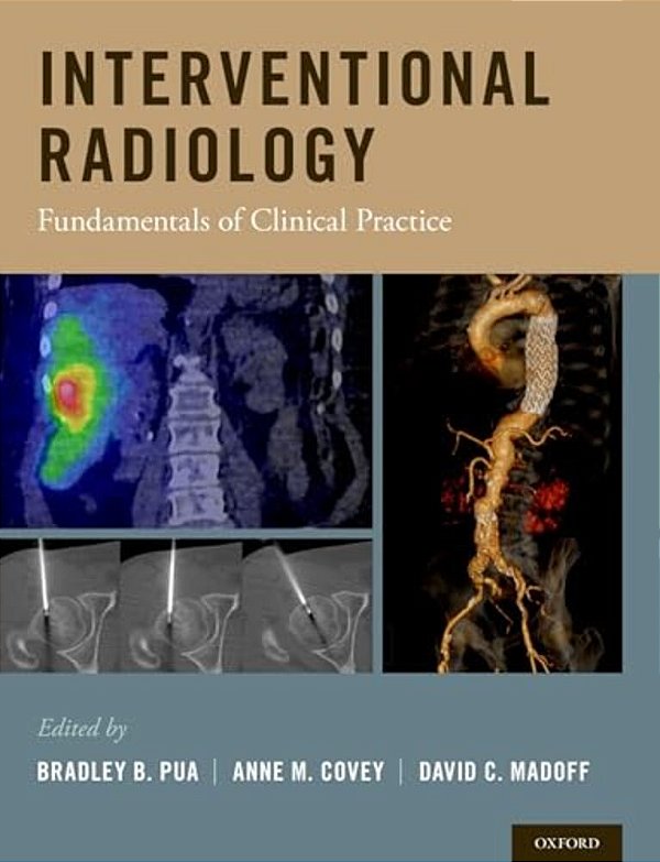 Interventional Radiology: Fundamentals Of Clinical Practice-..