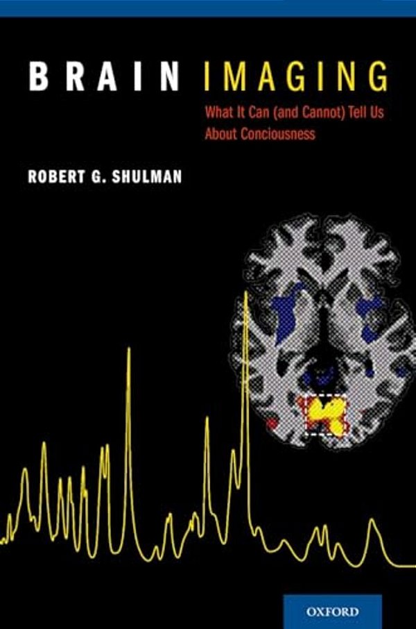 Brain Imaging: What It Can (And Cannot) Tell US About Consciousness-..