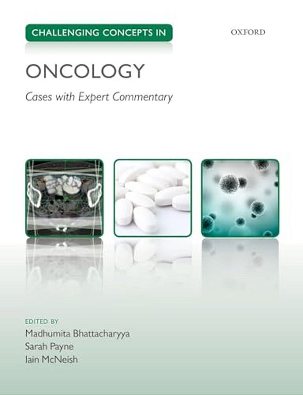 Challenging Concepts In Oncology: Cases With Expert Commentary-..