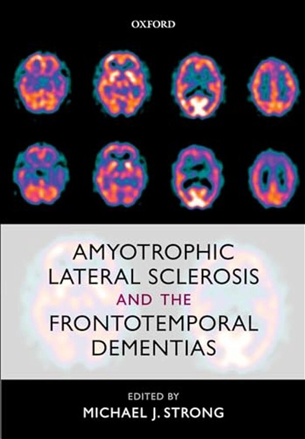 Amyotrophic Lateral Sclerosis And The Frontotemporal Dementias-..