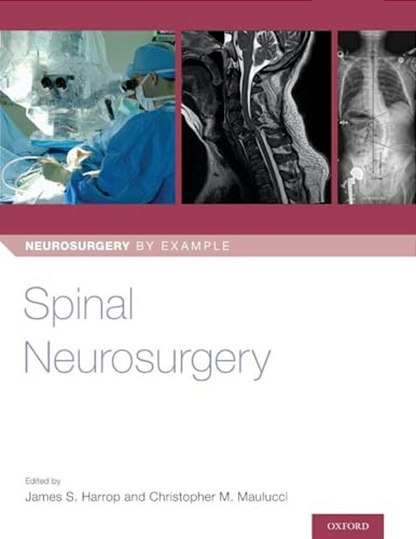 Spinal Neurosurgery-..