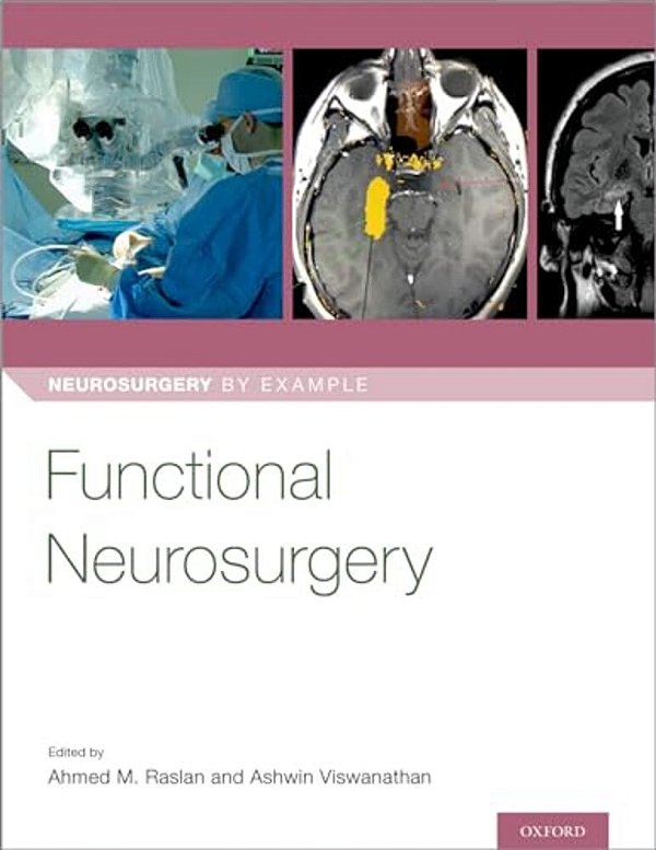 Functional Neurosurgery-..