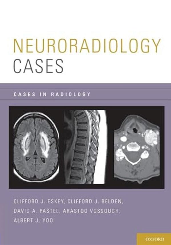 Neuroradiology Cases-..
