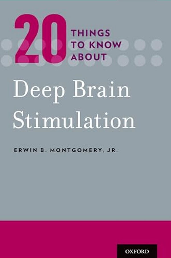 20 Things To Know About Deep Brain Stimulation-..