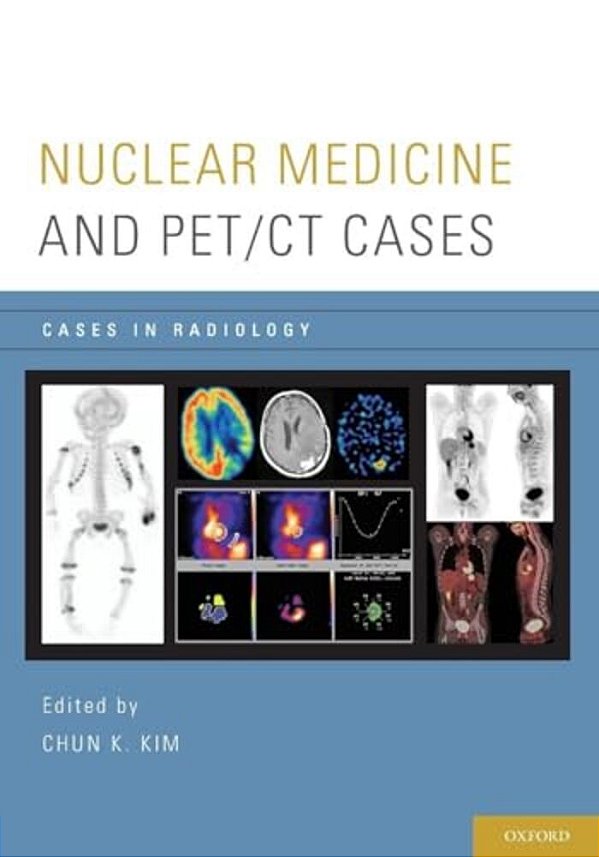 Nuclear Medicine And Pet/Ct Cases-..