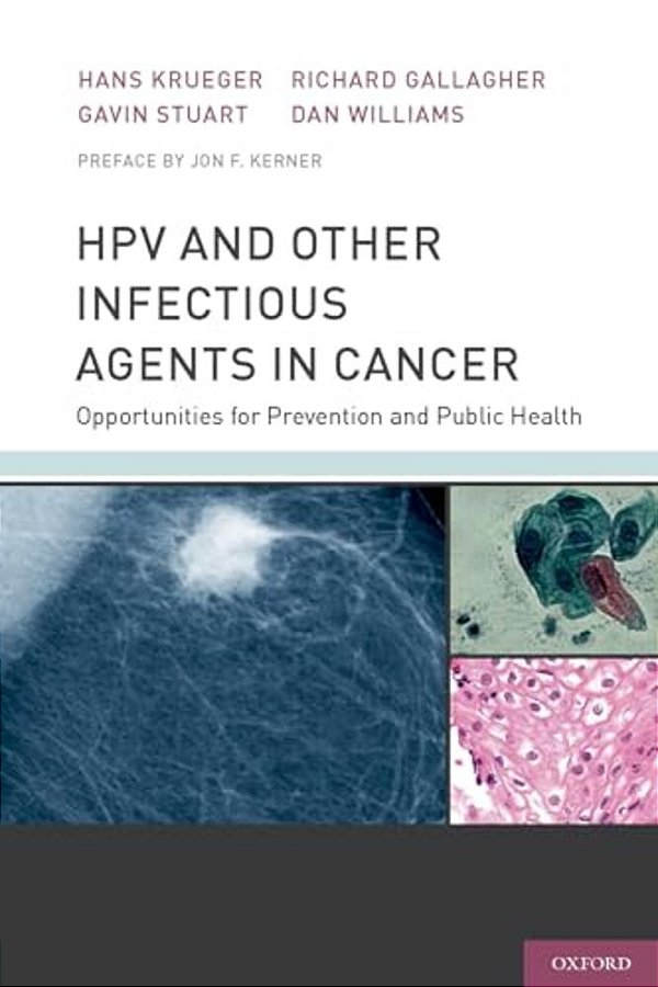 Hpv And Other Infectious Agents In Cancer: Opportunities For Prevention And Public Health-..