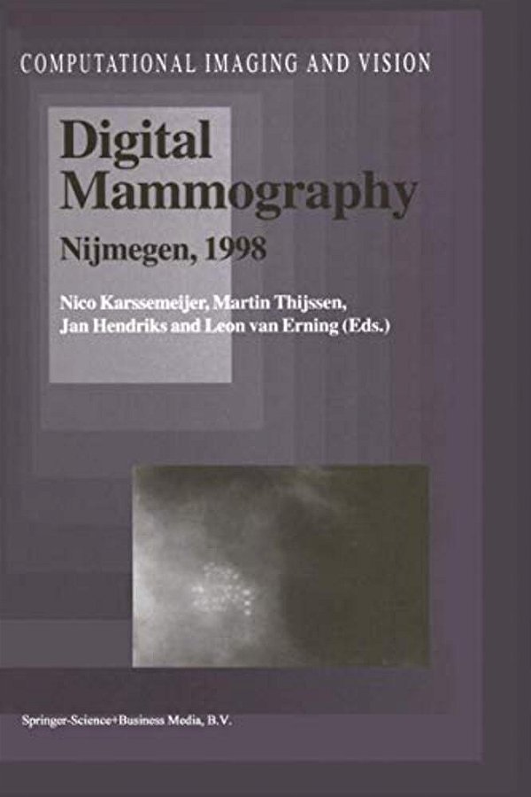 Digital Mammography: Nijmegen, 1998-..