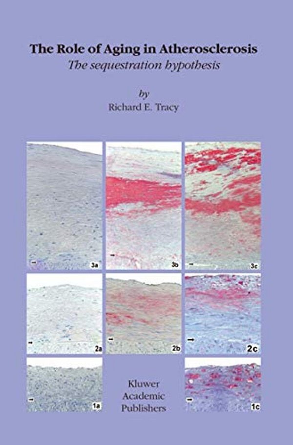 The Role Of Aging In Atherosclerosis: The Sequestration Hypothesis-..