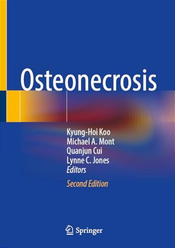 Osteonecrosis-..