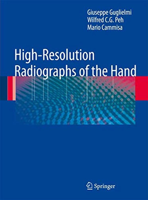 High-Resolution Radiographs Of The Hand-..