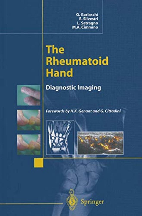 The Rheumatoid Hand: Diagnostic Imaging-..