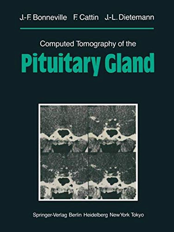 Computed Tomography Of The Pituitary Gland: With A Chapter On Magnetic Resonance Imaging Of The Sellar And Juxtasellar Region, By M. Mu Huo Teng And K-..