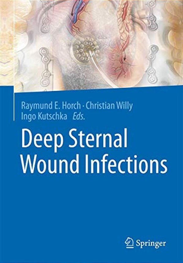 Deep Sternal Wound Infections-..