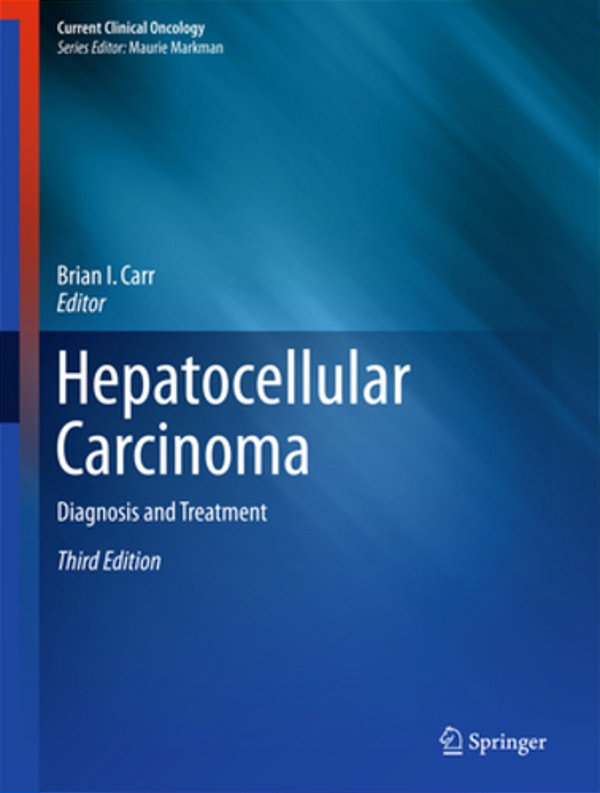Hepatocellular Carcinoma: Diagnosis And Treatment-..
