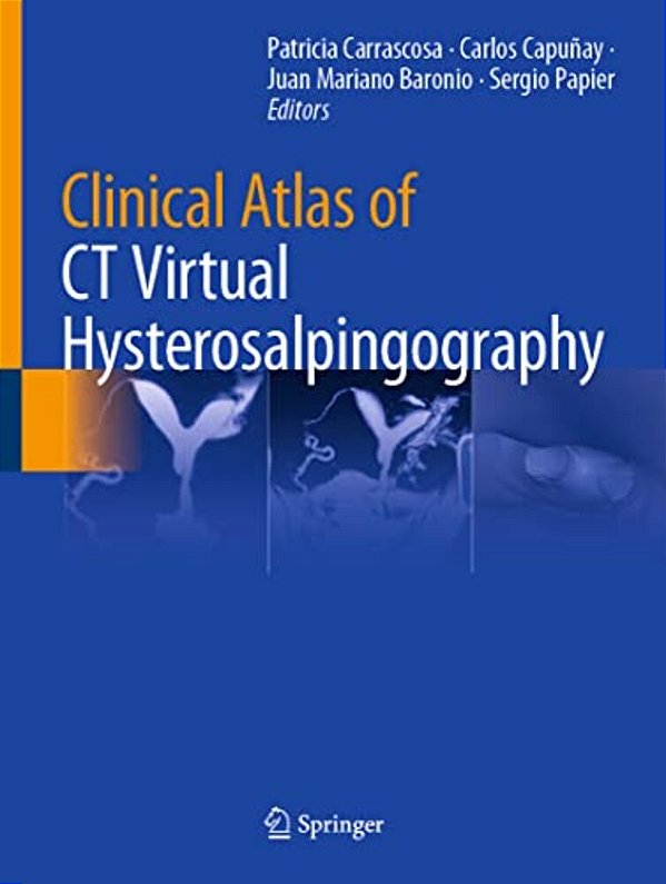 Clinical Atlas Of Ct Virtual Hysterosalpingography-..