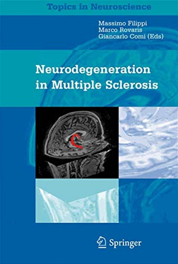 Neurodegeneration In Multiple Sclerosis-..