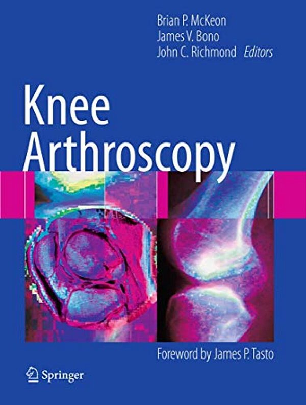 Knee Arthroscopy-..