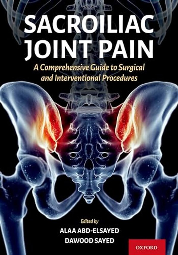 Sacroiliac Joint Pain: A Comprehensive Guide To Interventional And Surgical Procedures-..