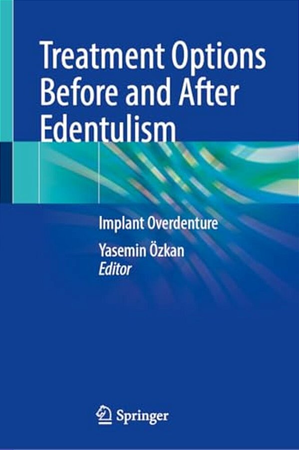 Treatment Options Before And After Edentulism: Implant Overdenture-..