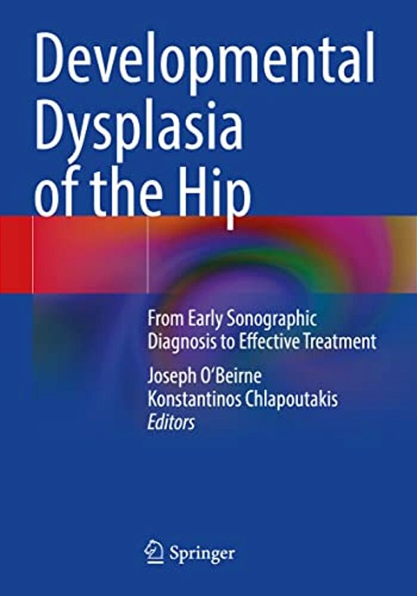 Developmental Dysplasia Of The Hip: From Early Sonographic Diagnosis To Effective Treatment-..