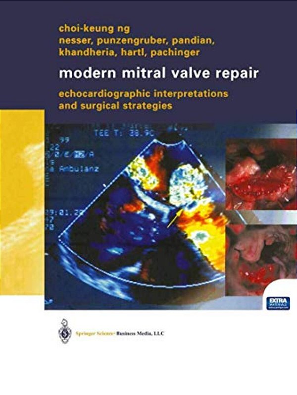 Modern Mitral Valve Repair: Echocardiographic Interpretations And Surgical Strategies-..