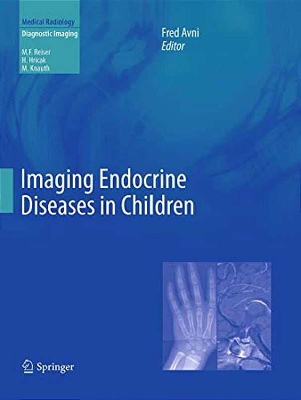 Imaging Endocrine Diseases In Children-..