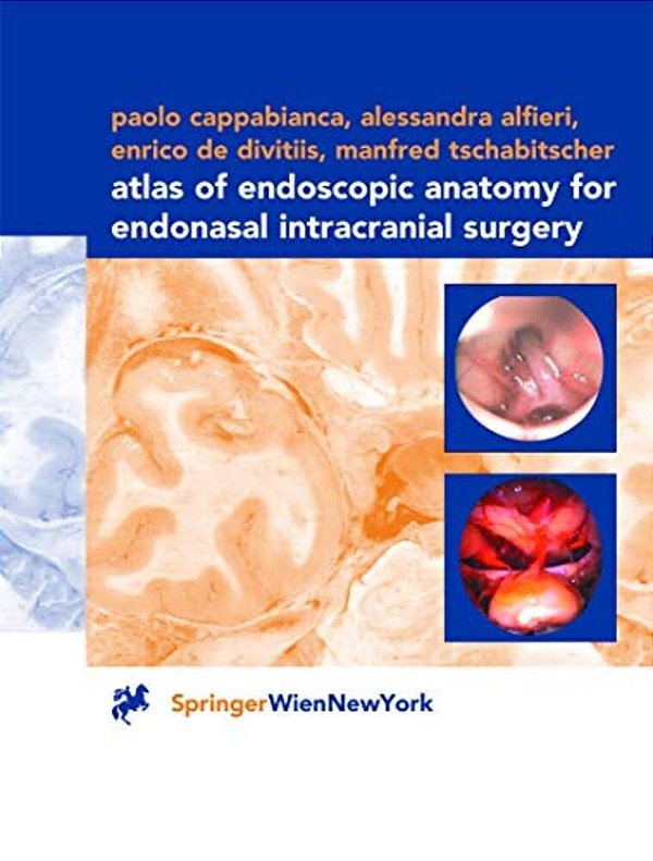 Atlas Of Endoscopic Anatomy For Endonasal Intracranial Surgery-..