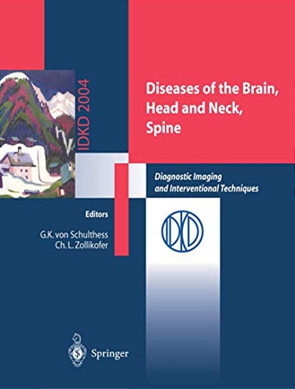 Diseases Of The Brain, Head And Neck, Spine: Diagnostic Imaging And Interventional Techniques-..