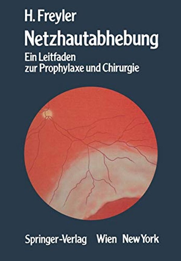 Netzhautabhebung: Ein Leitfaden Zur Prophylaxe Und Chirurgie-..