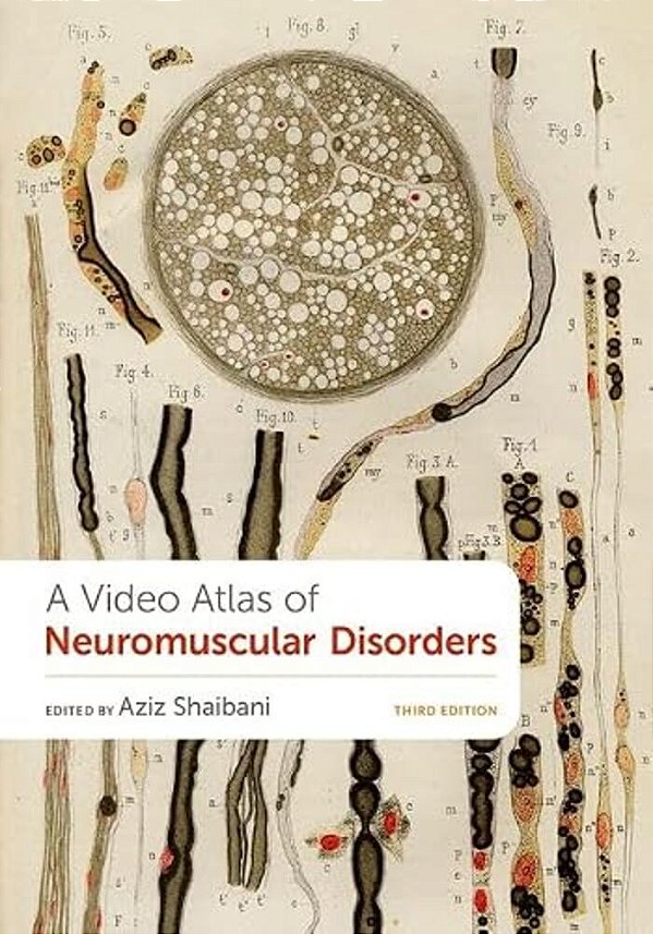 A Video Atlas Of Neuromuscular Disorders-..