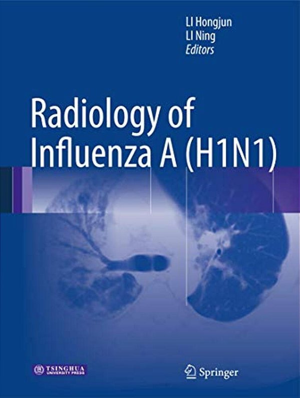 Radiology Of Influenza A (H1n1)-..