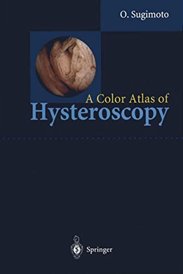 A Color Atlas Of Hysteroscopy-..
