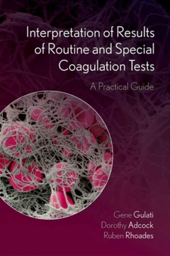 Interpretation Of Results Of Routine And Special Coagulation Tests: A Practical Guide-..