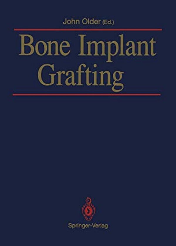 Bone Implant Grafting-..