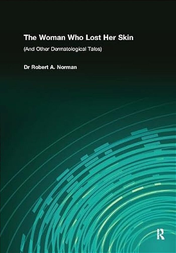 The Woman Who Lost Her Skin: (And Other Dermatological Tales)-..