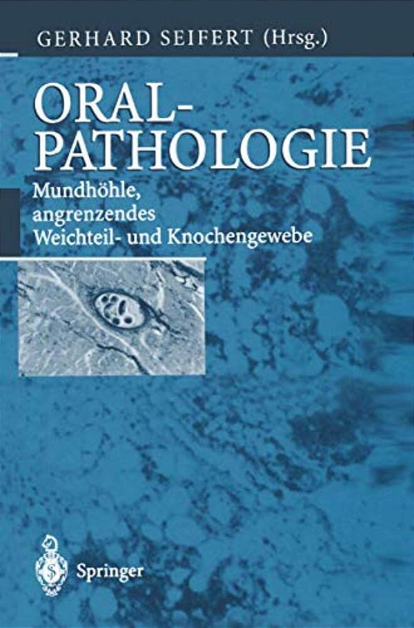 Oralpathologie: Mundhöhle, Angrenzendes Weichteil- Und Knochengewebe-..