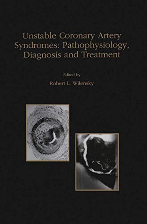 Unstable Coronary Artery Syndromes Pathophysiology, Diagnosis And Treatment-..