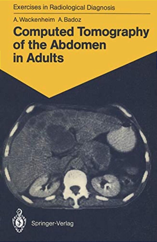 Computed Tomography Of The Abdomen In Adults: 85 Radiological Exercises For Students And Practitioners-..