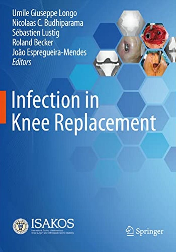 Infection In Knee Replacement-..
