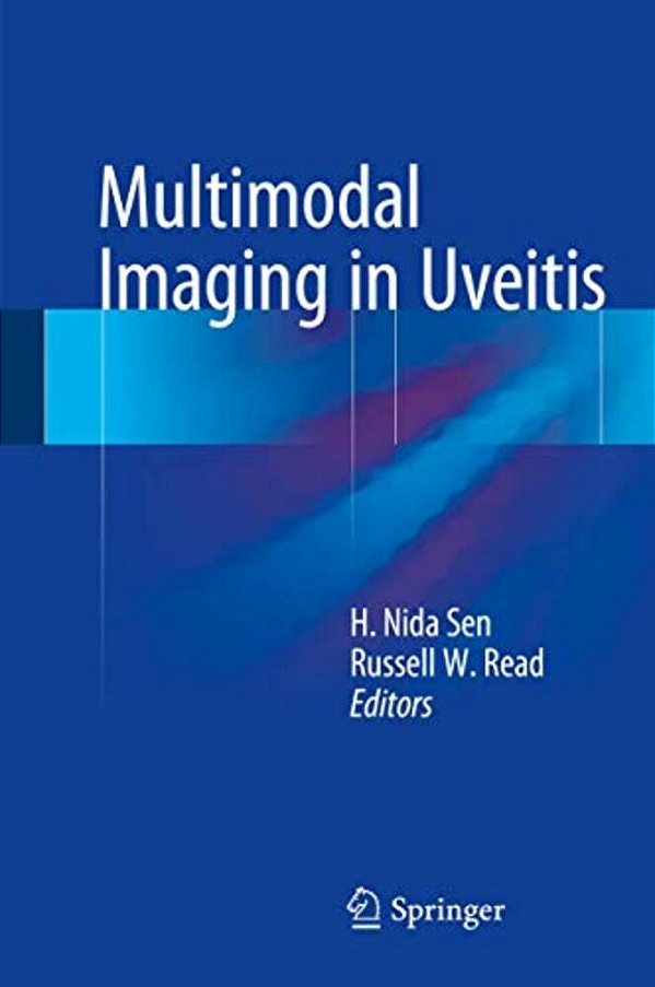 Multimodal Imaging In Uveitis-..