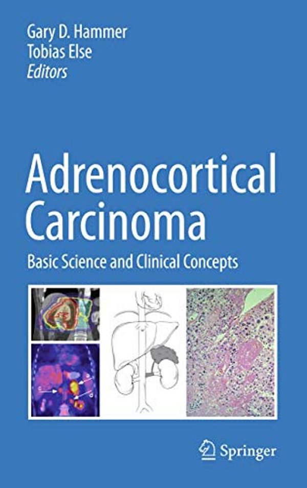 Adrenocortical Carcinoma: Basic Science And Clinical Concepts-..