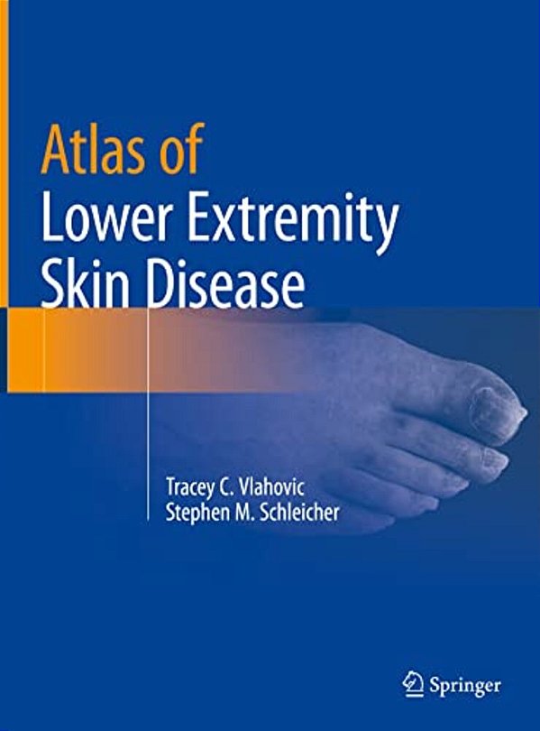 Atlas Of Lower Extremity Skin Disease-..