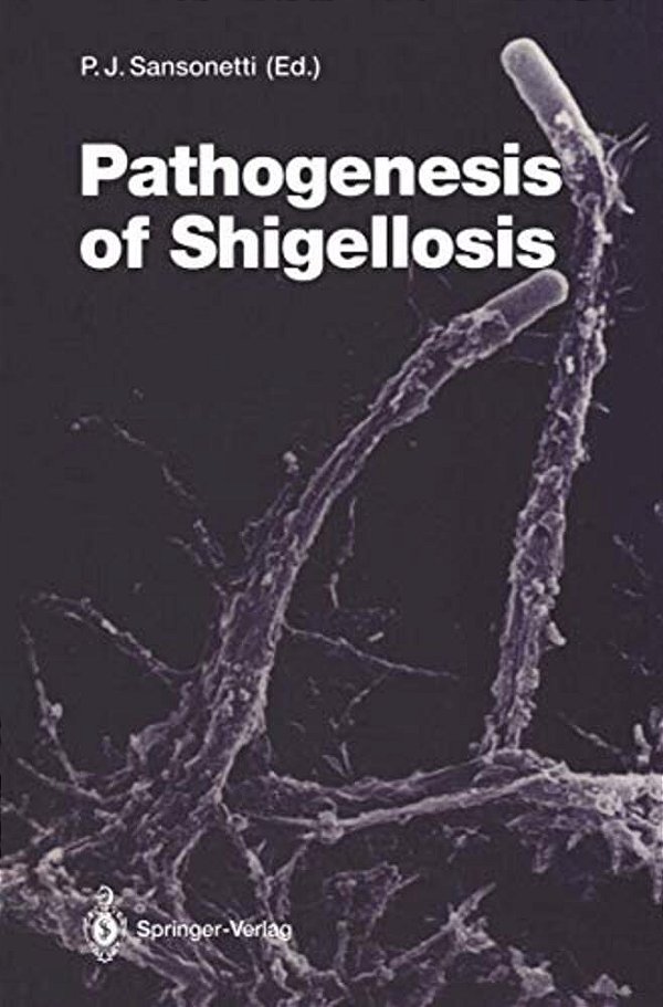 Pathogenesis Of Shigellosis-..