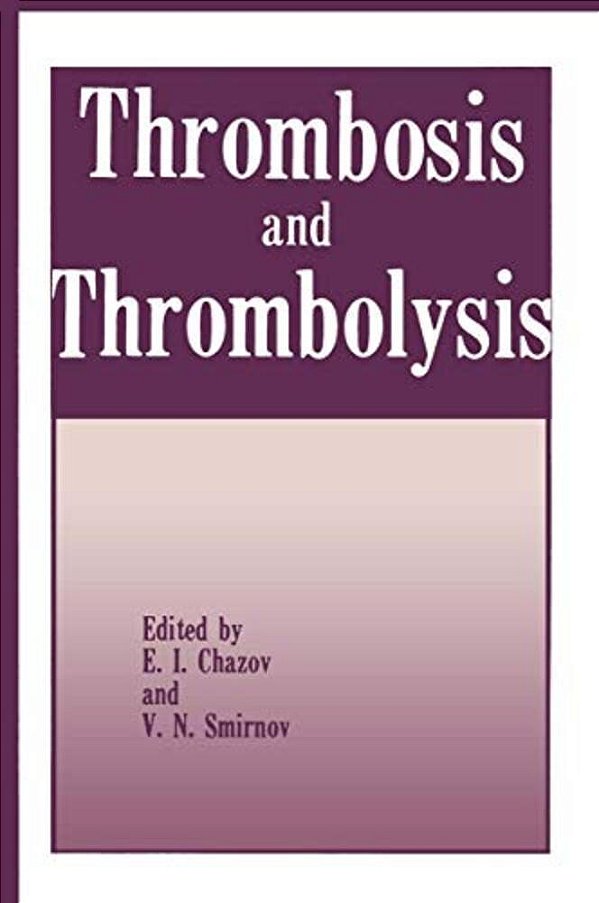 Thrombosis And Thrombolysis-..