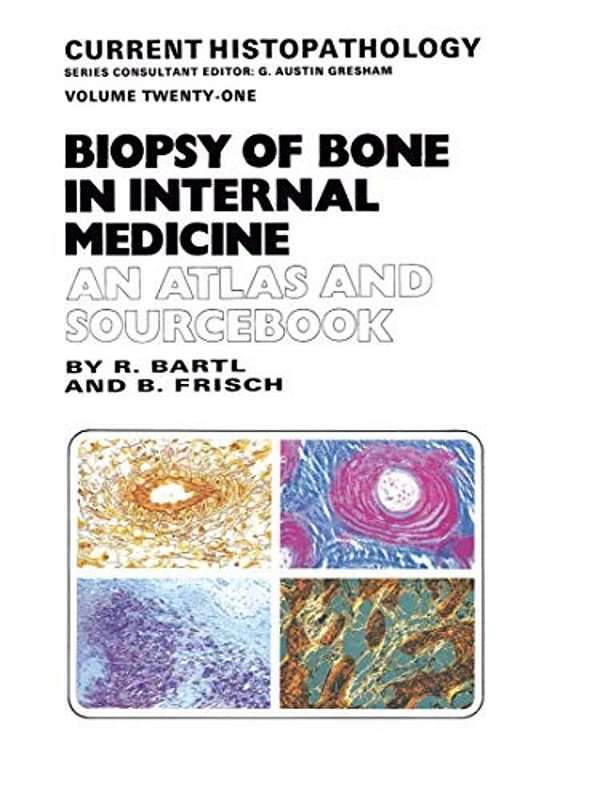 Biopsy Of Bone In Internal Medicine: An Atlas And Sourcebook-..