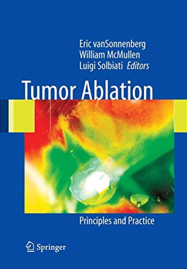 Tumor Ablation: Principles And Practice-..