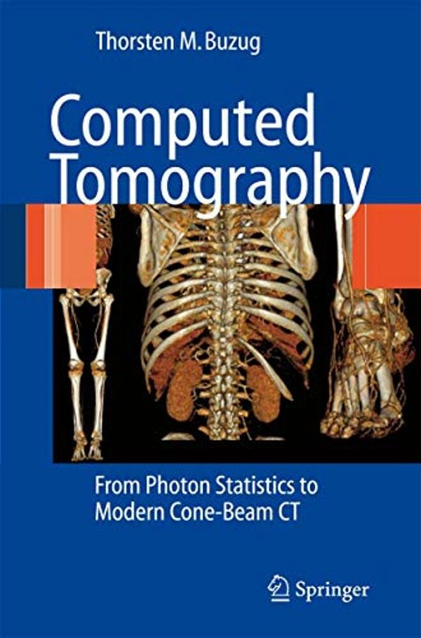 Computed Tomography: From Photon Statistics To Modern Cone-Beam Ct-..
