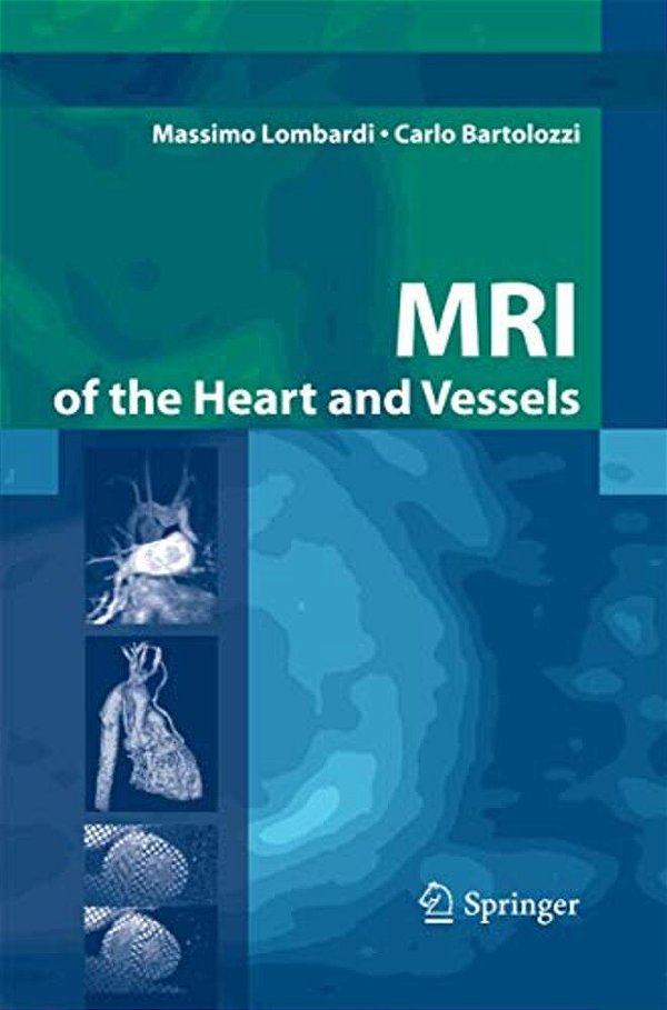 Mri Of The Heart And Vessels-..
